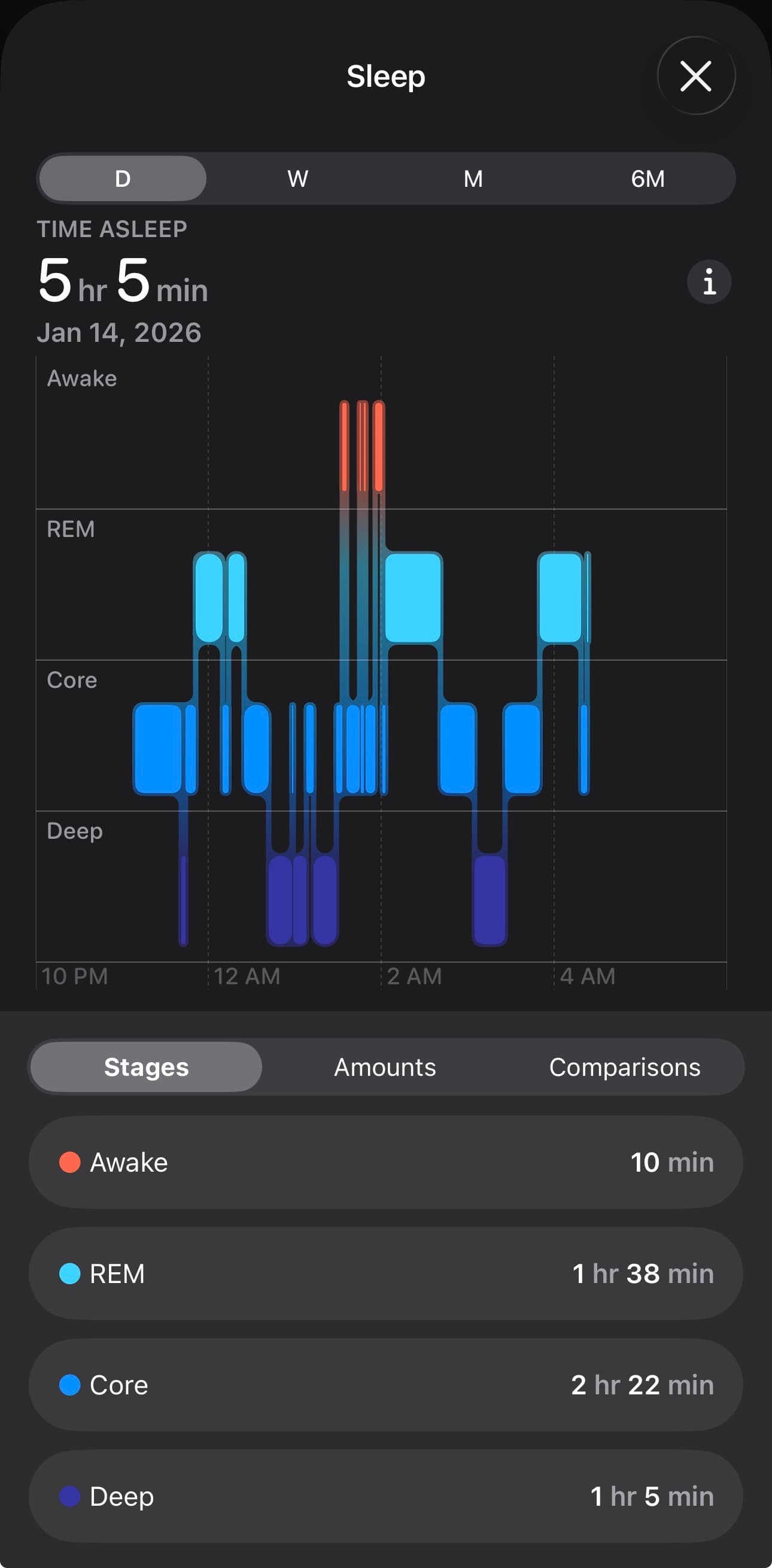 Apple Watch sleep stages showing deep, core, and REM distribution